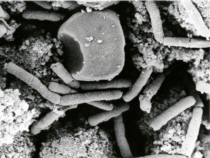 This undated file electronmicrograph from the official U.S. Department of Defense anthrax information Web Site shows Bacillus anthracis vegetative cells in a monkey spleen