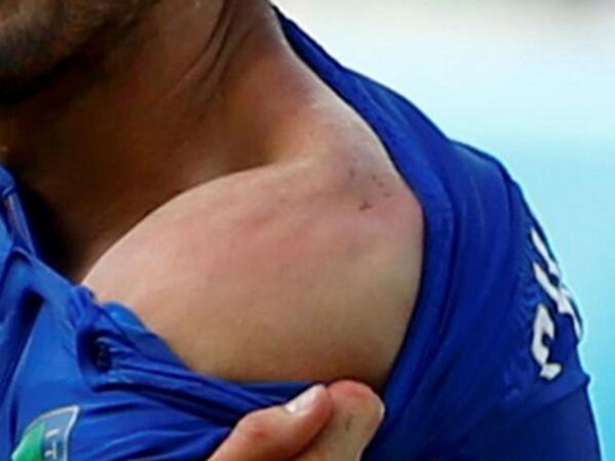 Chiellini shows the marks left on shoulder