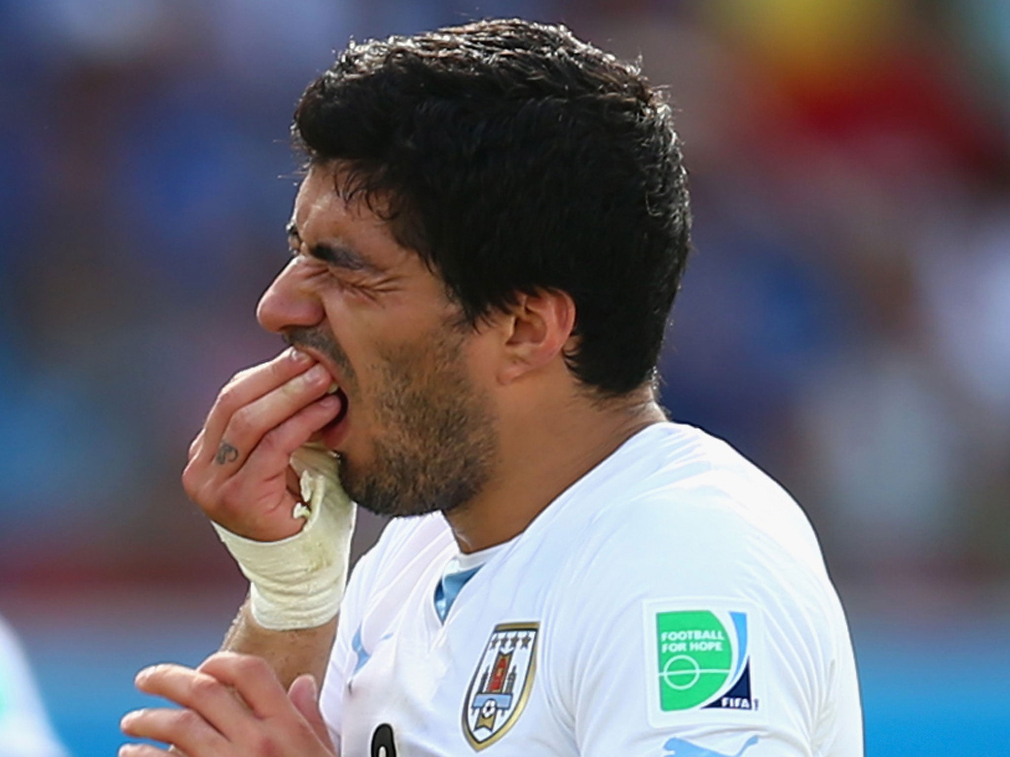 Luis Suarez holds his teeth after colliding with Giorgio Chiellini