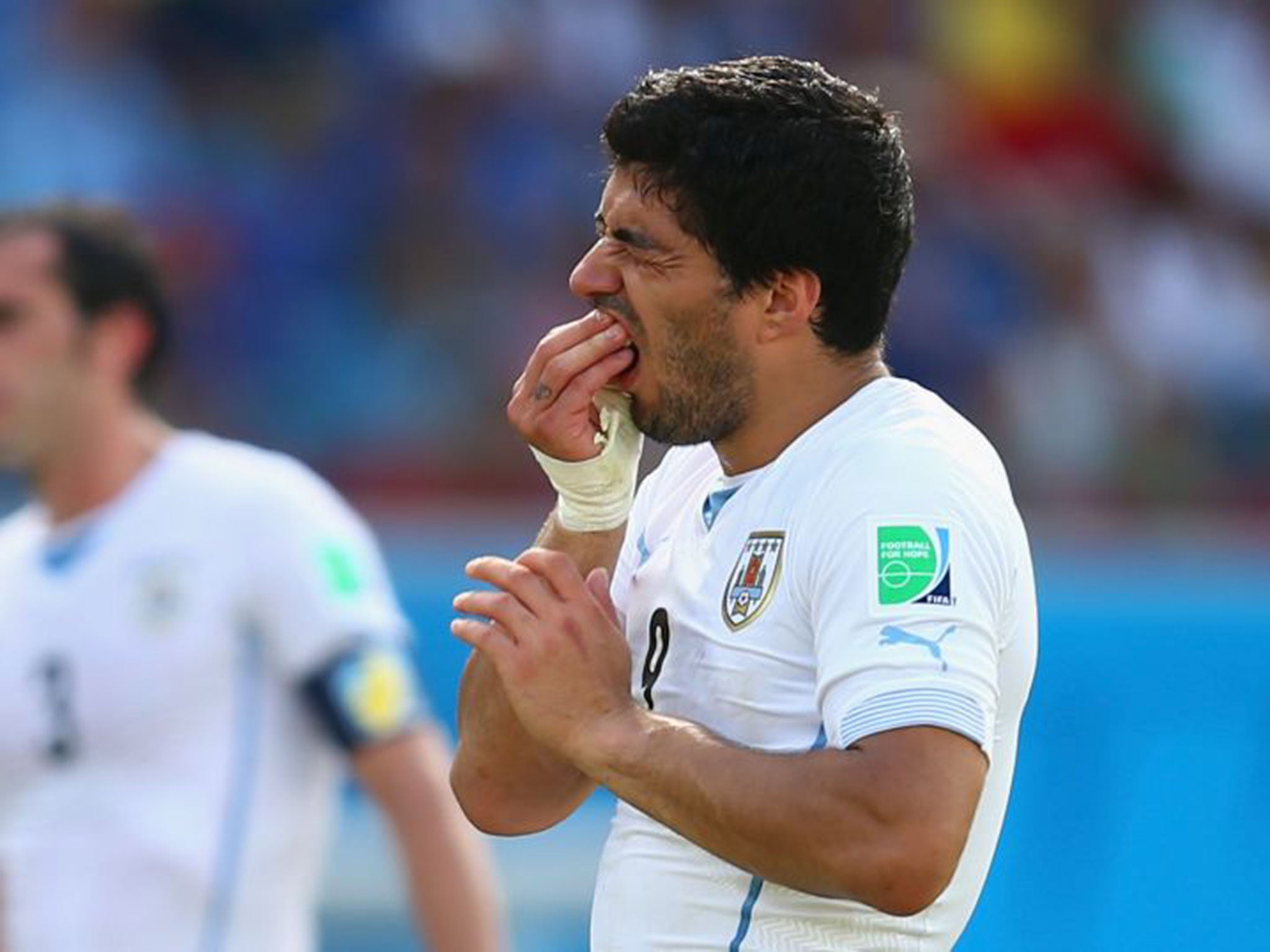 Luis Suarez holds his teeth after biting Giorgio Chiellini