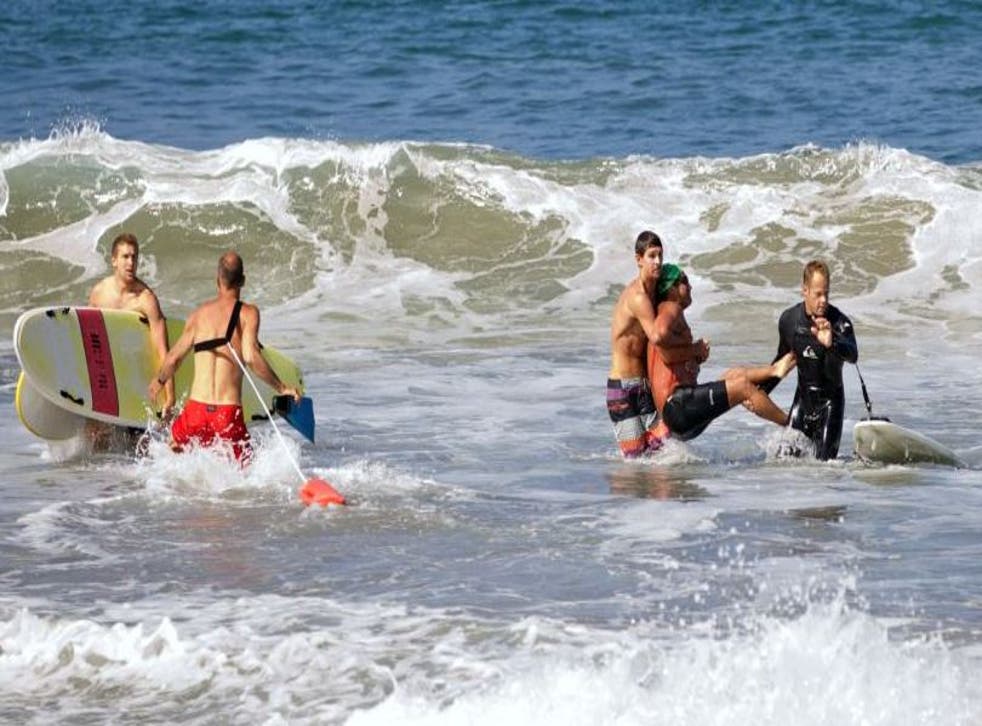 A man was injured in a shark attack off the Californian coast