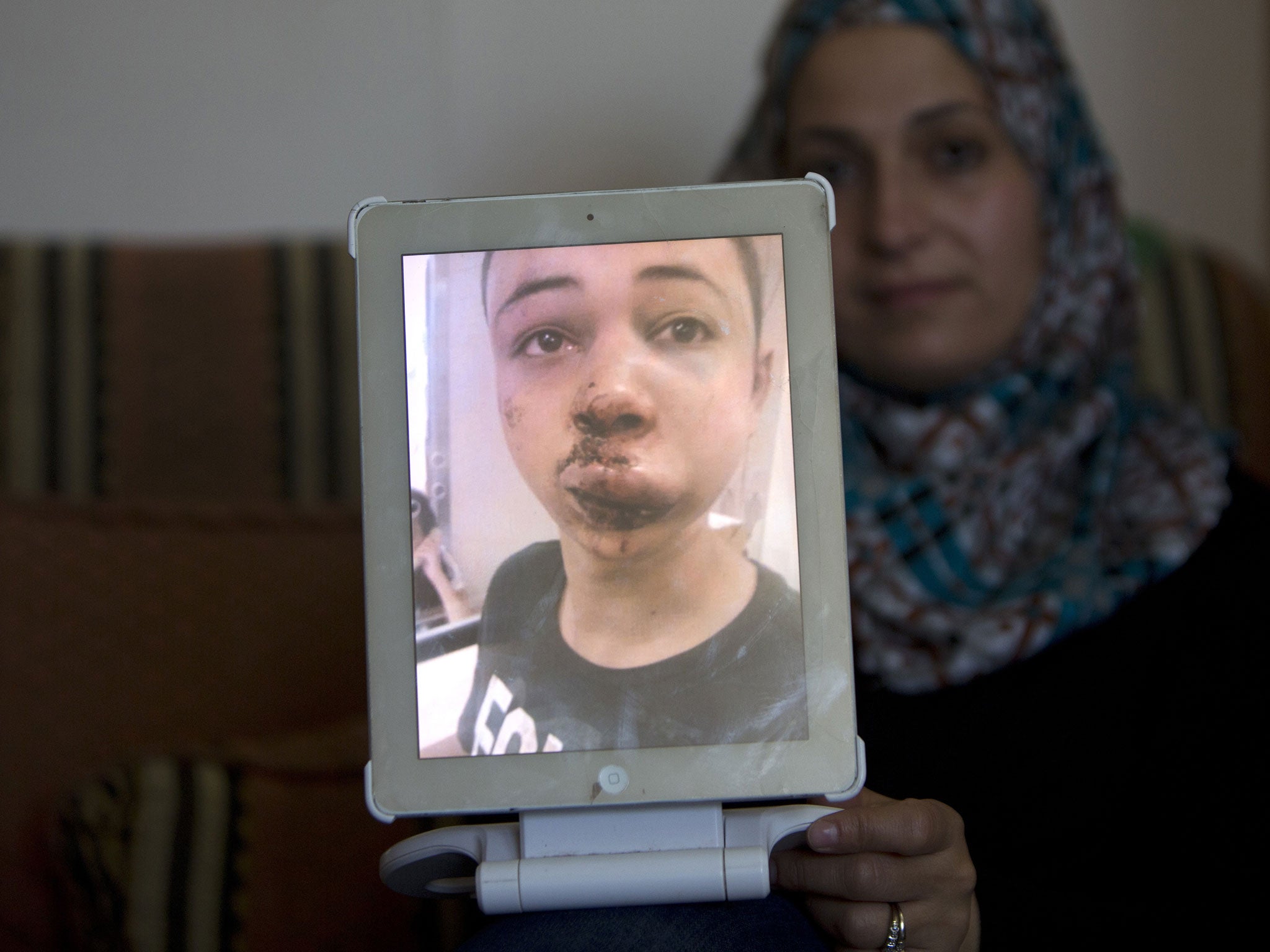 The mother of Tariq Abu Khdeir, who was allegedly beaten by Israeli police, holds up a picture of her son's swollen and bloodied face.