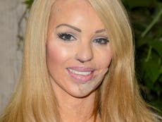 Katie Piper: If you aren't on the Organ Donor Register, ask yourself why