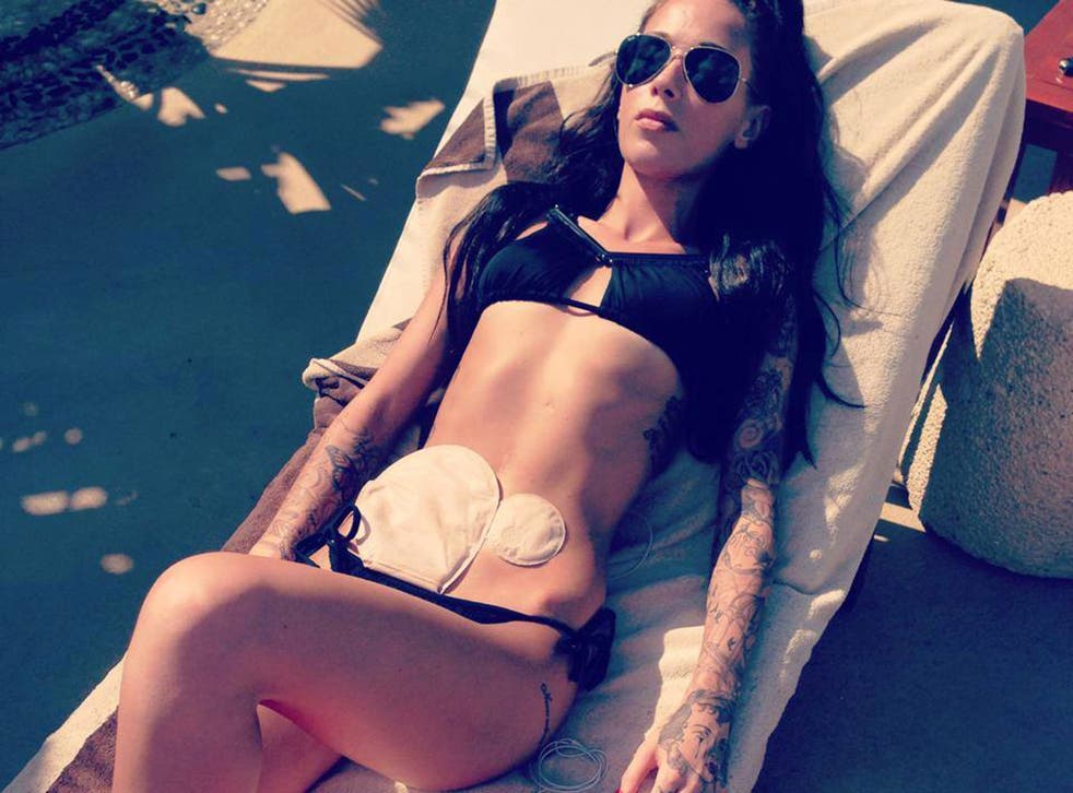 23-year-old make-up artist Bethany Townsend, who has been praised by Inflammatory Bowel Disease charities for posting a photo of herself on holiday wearing her colostomy bag