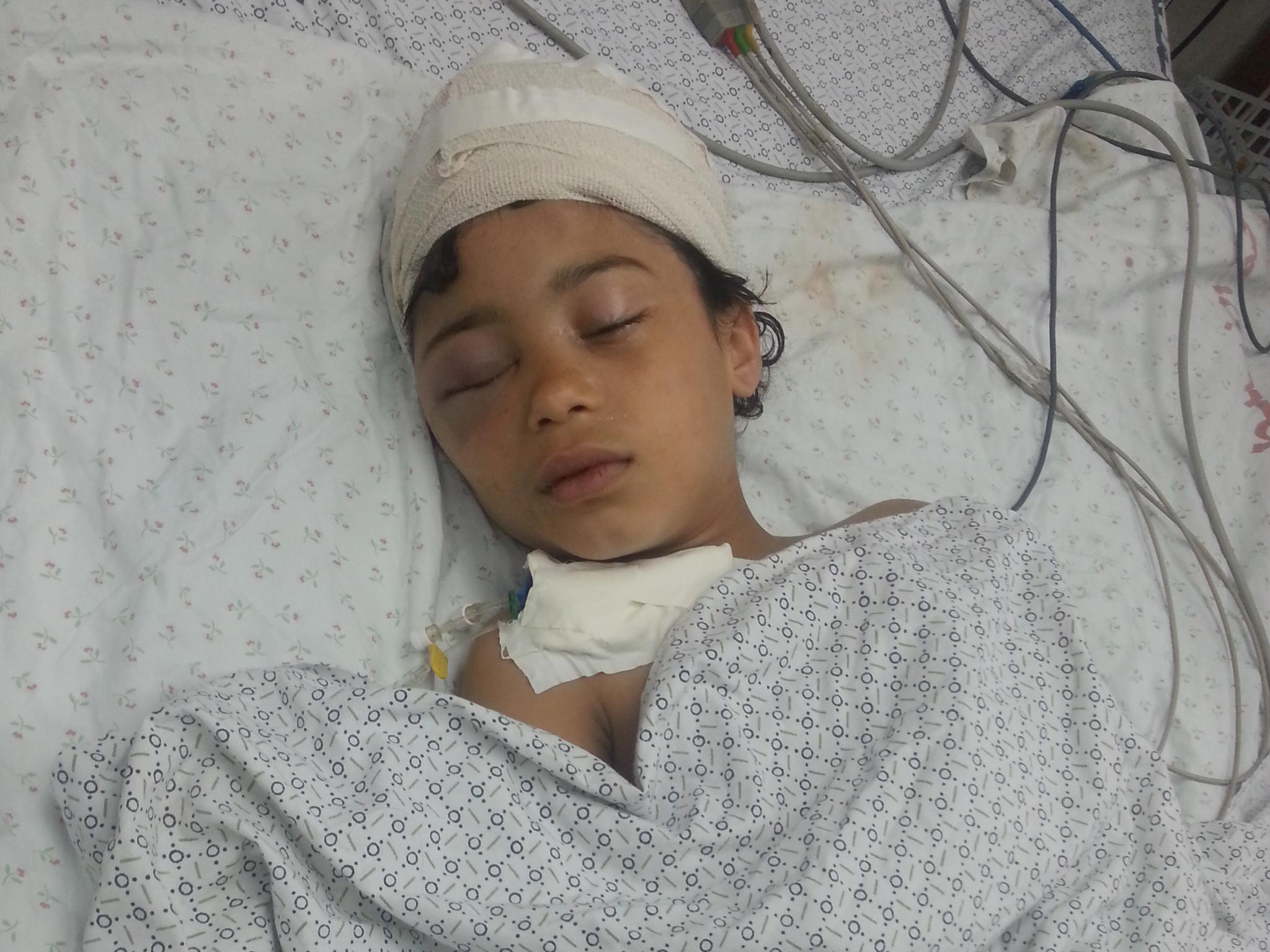 Mariam Al-Masery lies in intensive care at al-Shifa hospital after an Israeli air strike on Gaza City