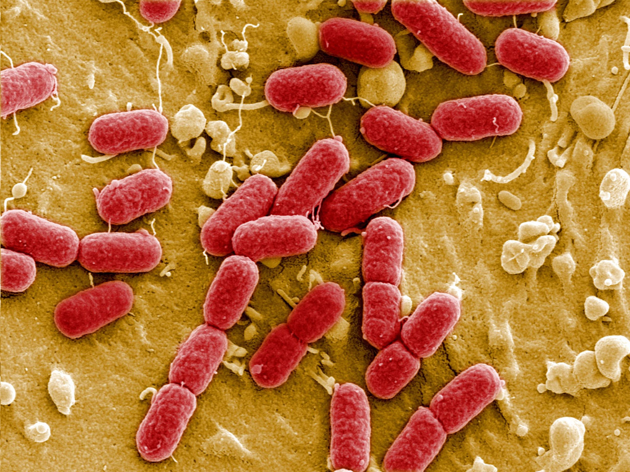 Antimicrobial resistance occurs when bacteria evolve genetically so that they cannot be killed by antibiotic drugs