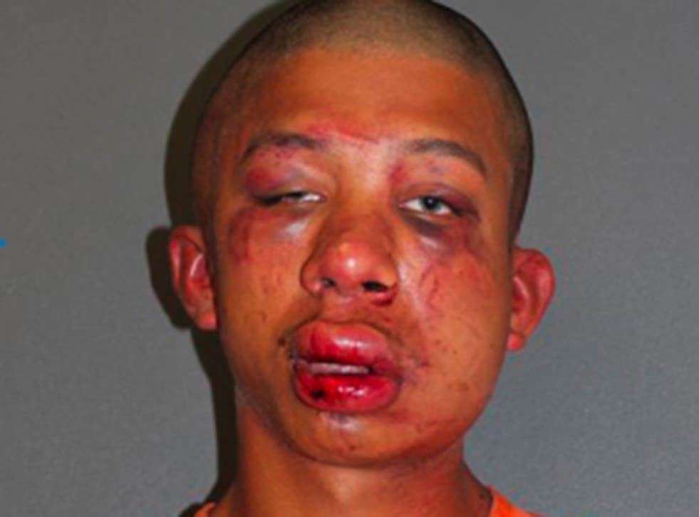 Raymond Frolander, 18, was beaten up when he was caught carrying out a sexual assault on an 11-year-old