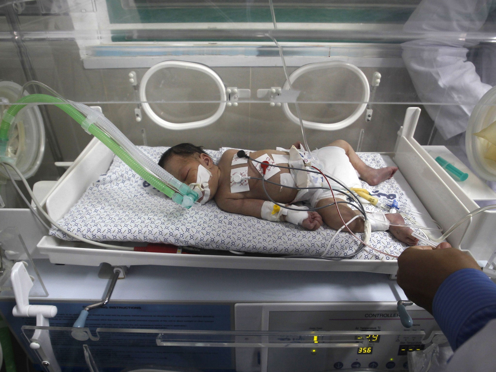 A Palestinian baby girl, Shayma Sheikh al-Eid, lies in an incubator at Nasser Hospital, two days after surgeons delivered her after her 23-year-old mother died, on July 27, 2014