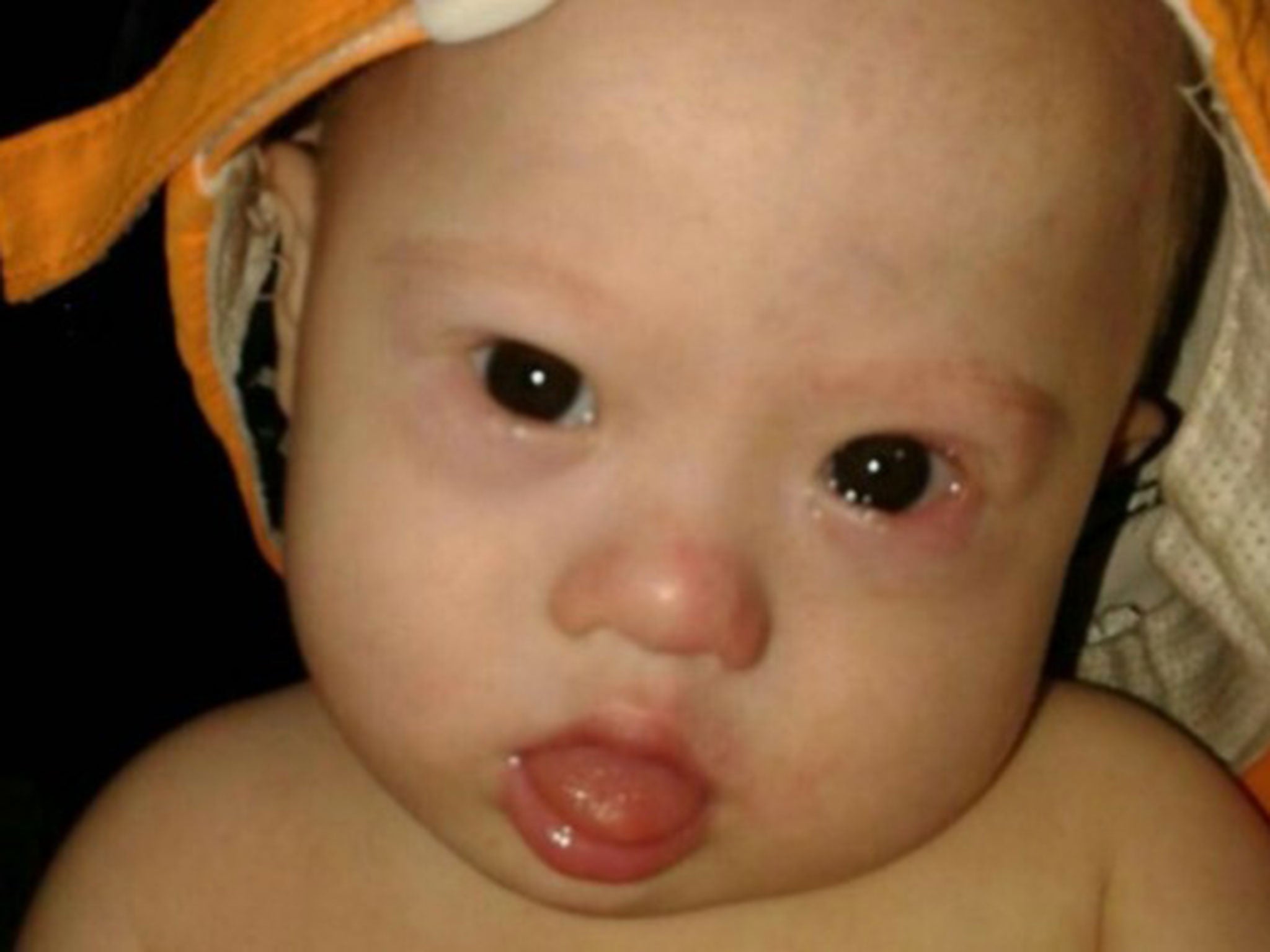 The six-month-old baby known as Gammy who was left with his surrogate 