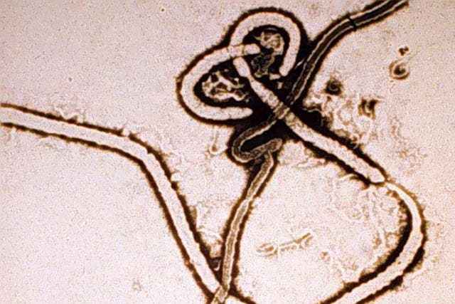 An electron micrograph of the Ebola virus