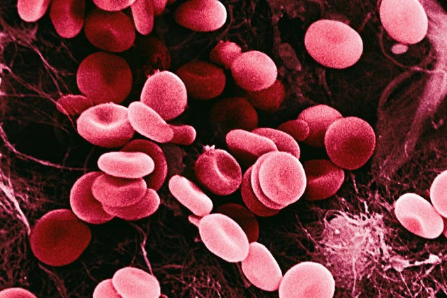 Haemophilia patients have a faulty gene meaning their blood won't clot naturally