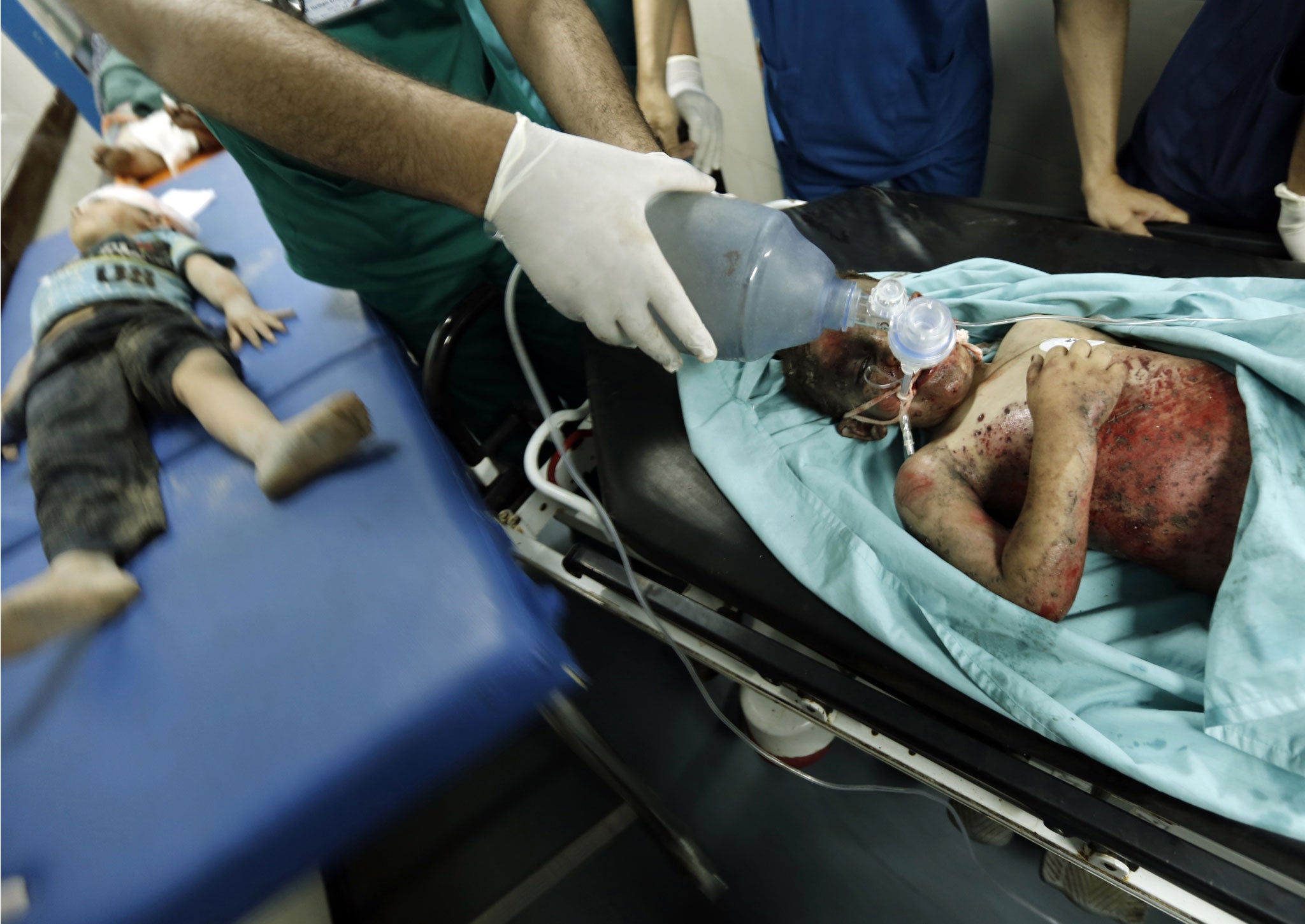 Palestinian children, wounded in an Israeli air strike on the al-Shati refugee camp, lie on stretchers as they are treated at the al-Shefa hospital in Gaza City, on August 4, 2014