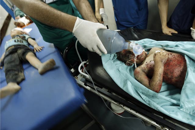 Palestinian children, wounded in an Israeli air strike on the al-Shati refugee camp, lie on stretchers as they are treated at the al-Shefa hospital in Gaza City, on August 4, 2014
