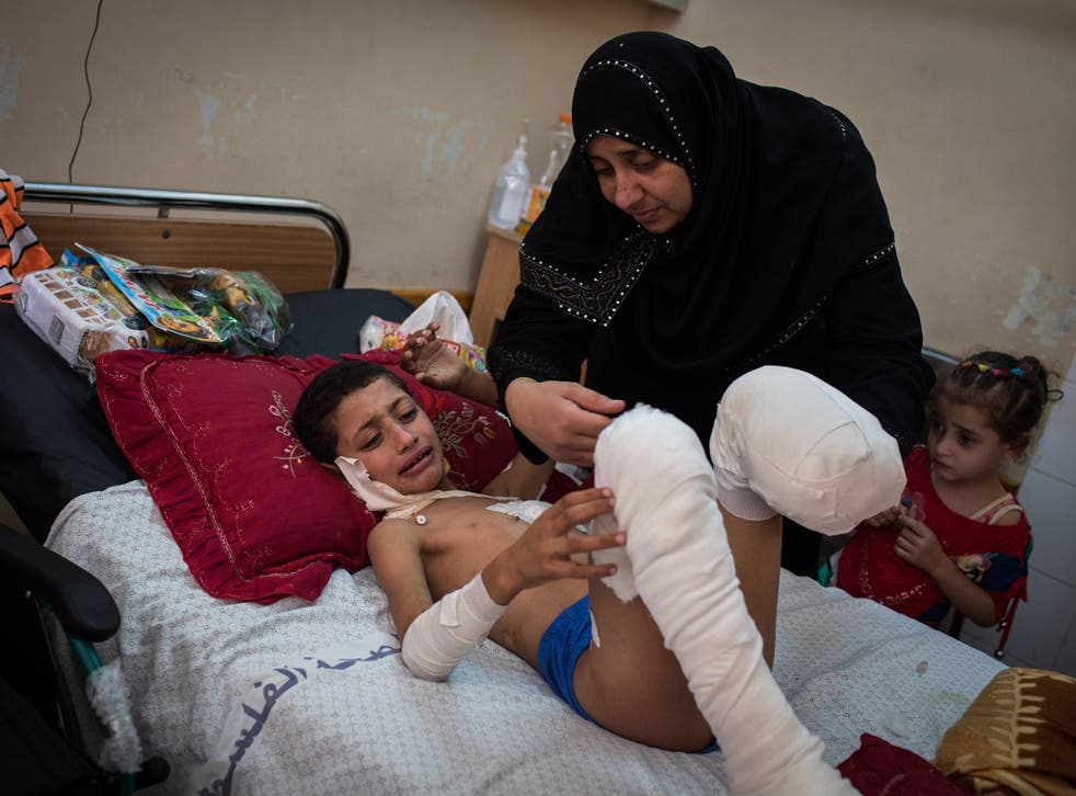 Ibrahim Kattab, 6, crys out as his mother, Khetam, 39, and sister, Nermine, 3, watch over him, in Shifa Hospital, Gaza city. Ibrahim and his brother, Wasim, were hit by shrapnel