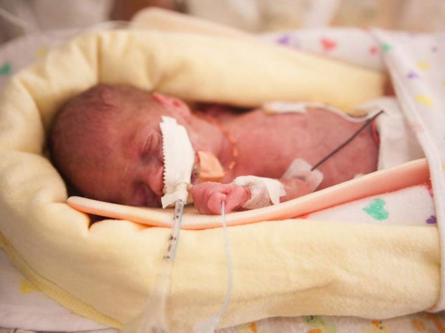 Baby Walker Pruett was born weighing just over one pound