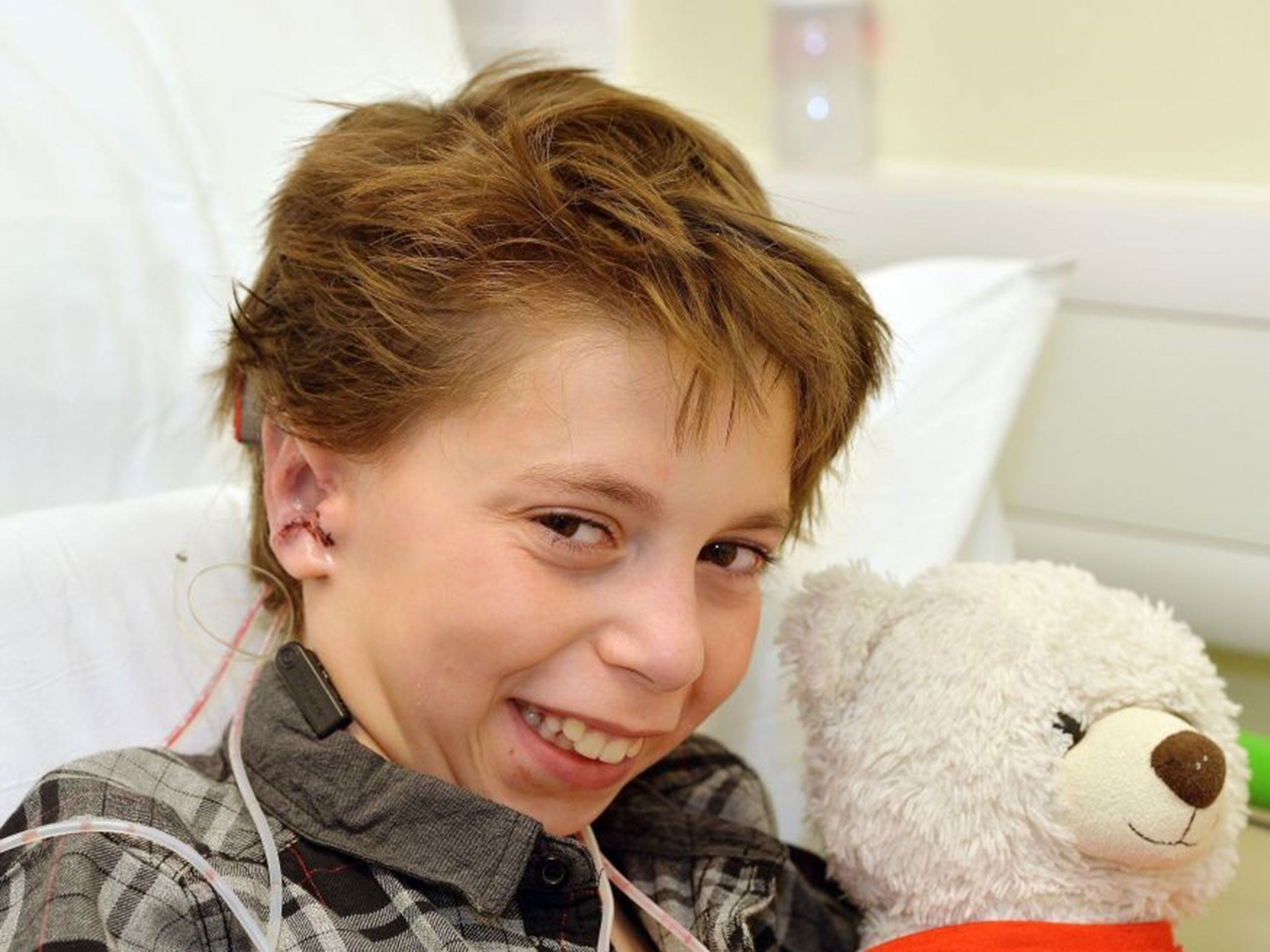 Kieran Sorkin has received a new set of ears after experts at Great Ormond Street Hospital (GOSH) performed a six hour operation where they used cartilage from his ribs to create a pair of ears and grafted them to his head