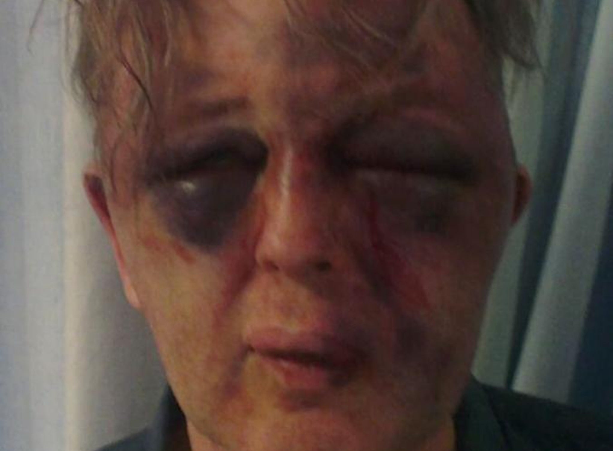 Paul Kohler, 55, sustained severe facial injuries in an aggravated burglary