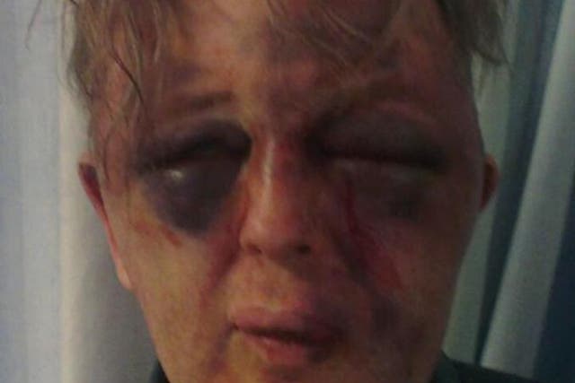 Paul Kohler, 55, sustained severe facial injuries in an aggravated burglary