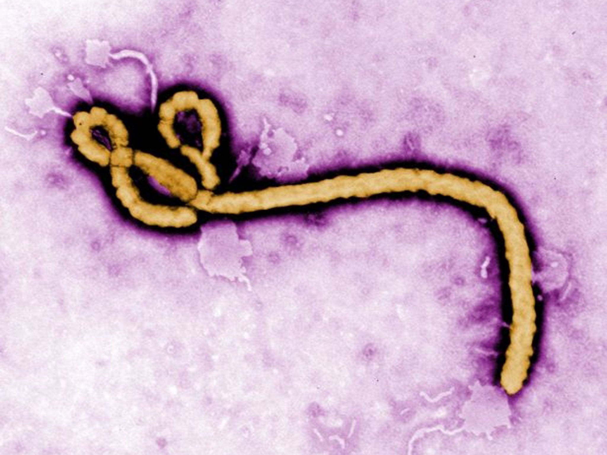 Undated Centers for Disease Control and Prevention (CDC) handout photo of the ebola virus. Health chiefs are awaiting blood test results today on a suspected Ebola case in Ireland after a man who recently returned from Africa died suddenly.