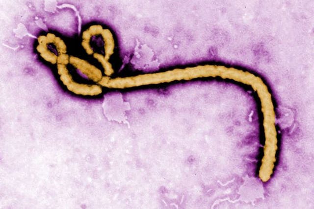 Undated Centers for Disease Control and Prevention (CDC) handout photo of the ebola virus. Health chiefs are awaiting blood test results today on a suspected Ebola case in Ireland after a man who recently returned from Africa died suddenly. 