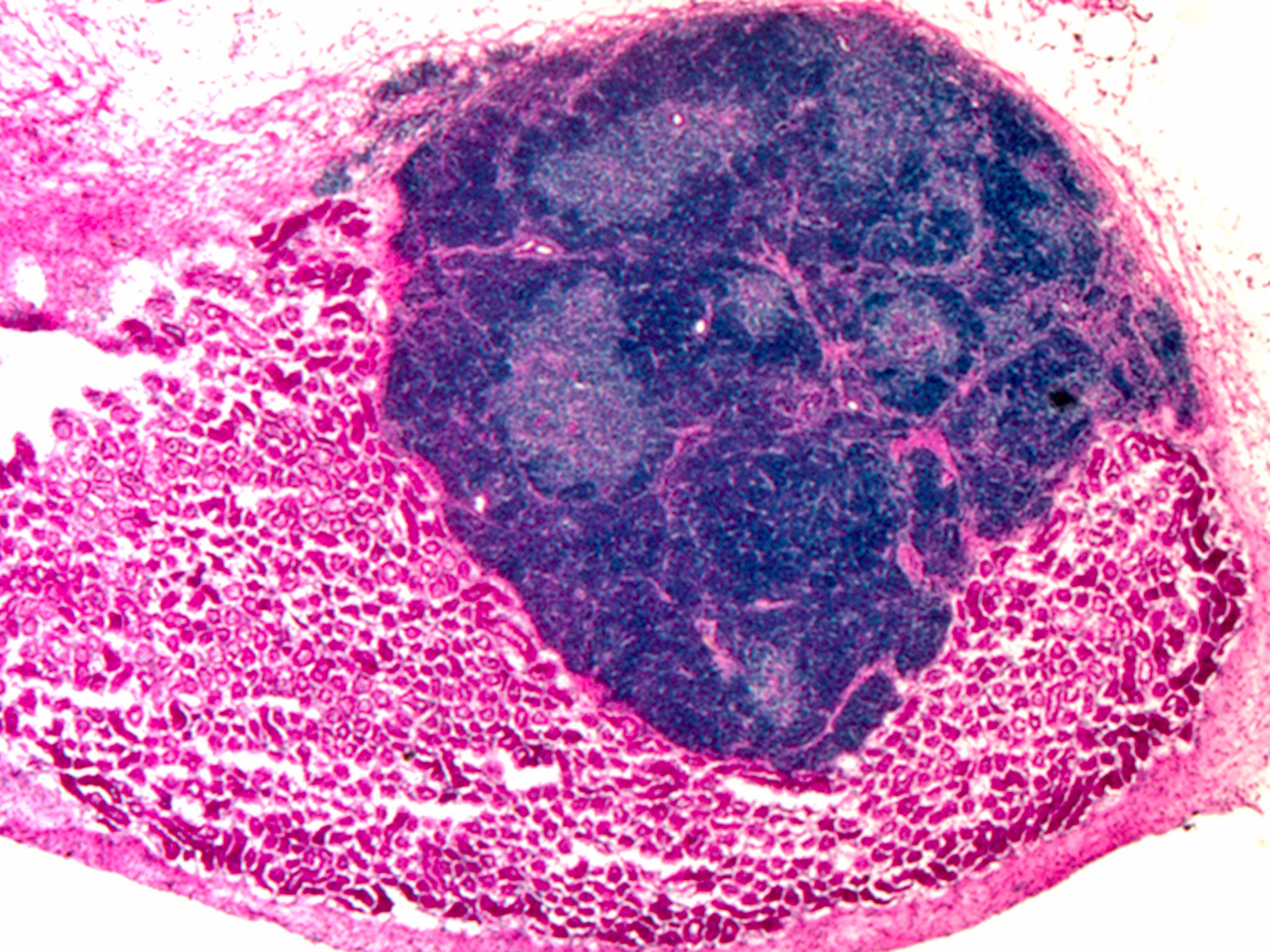 Photo issued by Medical Research Council of induced thymic epithelial cells (iTECs) transplanted onto a mouse kidney to form an organised and functional mini-thymus (Kidney cells in pink; thymus cells dark blue). Reprogrammed cells created in a laboratory