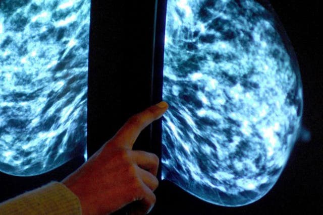A doctor inspects a mammogram