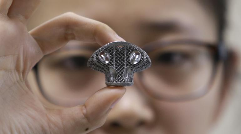 A doctor from Peking University hospital in Beijing displays the 3D-printed vertebra, constructed from aluminium powder