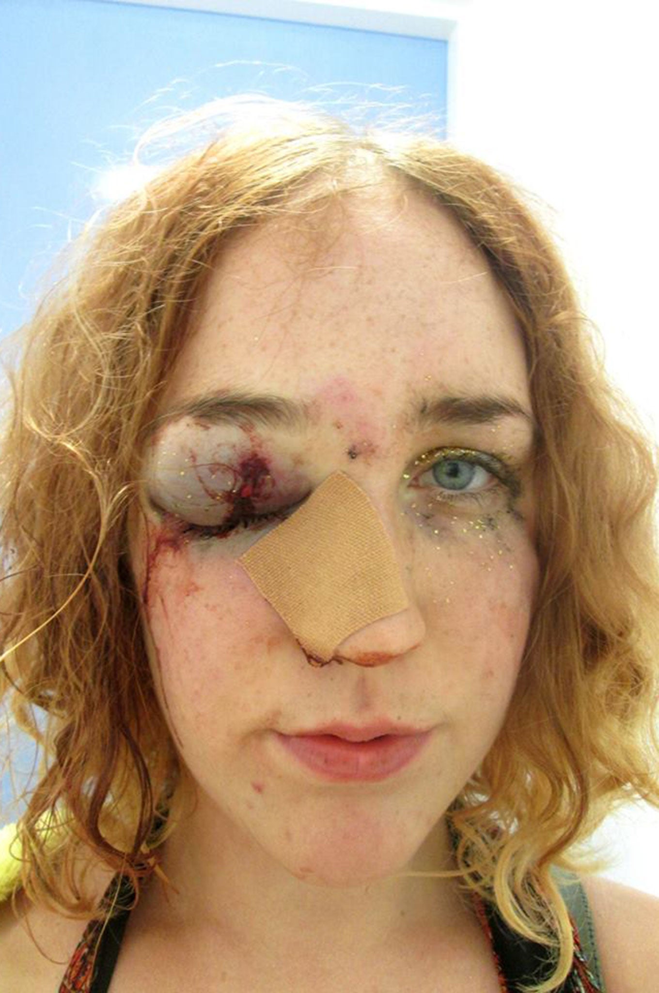 Mary Brandon posted this image to Facebook after she said she was hit in the face for telling a man to stop groping her