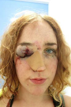 Woman shares selfie after being ‘punched in face'