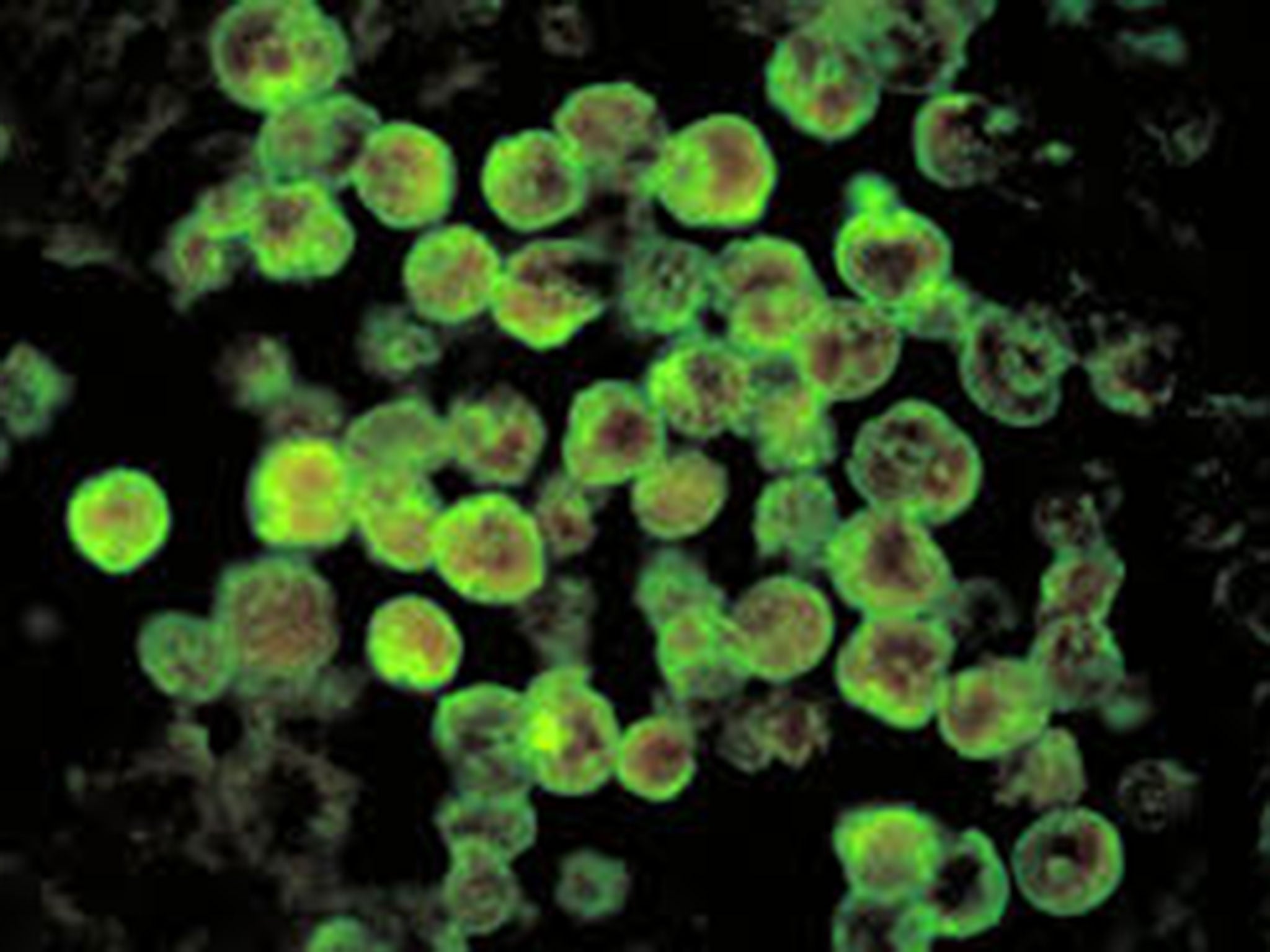 The Naegleria fowleri bug was discovered during standard testing by the Louisiana Department of Health and Hospitals (DHH) in a water system used by 12,577 people