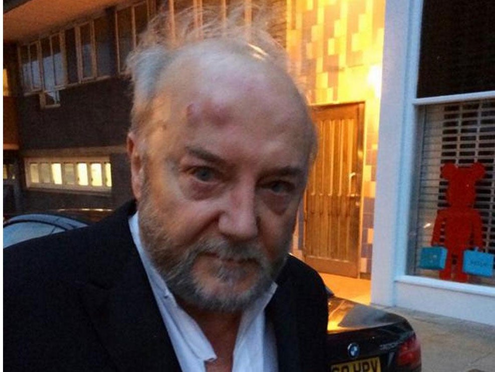 George Galloway on his way to hospital after being attacked in London