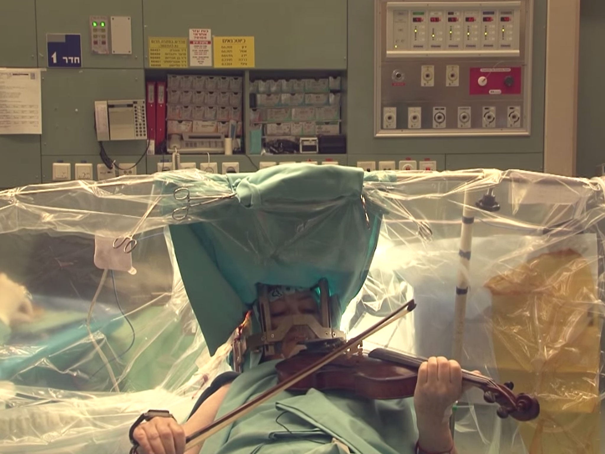 A still from a video showing former professional violinist Naomi Elishuv being operated on at Tel Aviv Sourasky Medical Centre