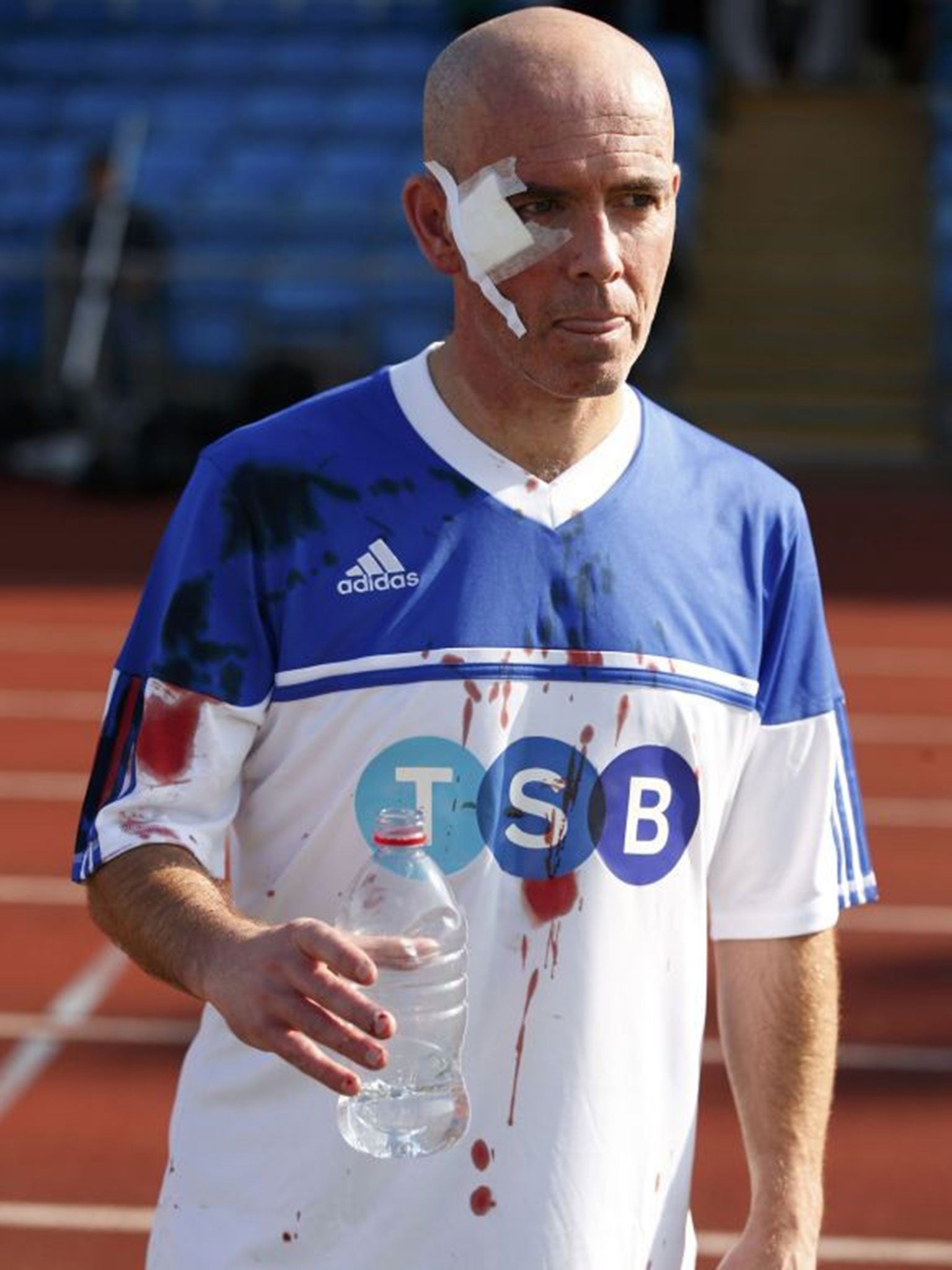 Reporter Rob Merrick holds a bottle of water after receiving a cut to his face in a tackle with shadow chancellor Ed Balls during the Labour Party versus the media soccer match