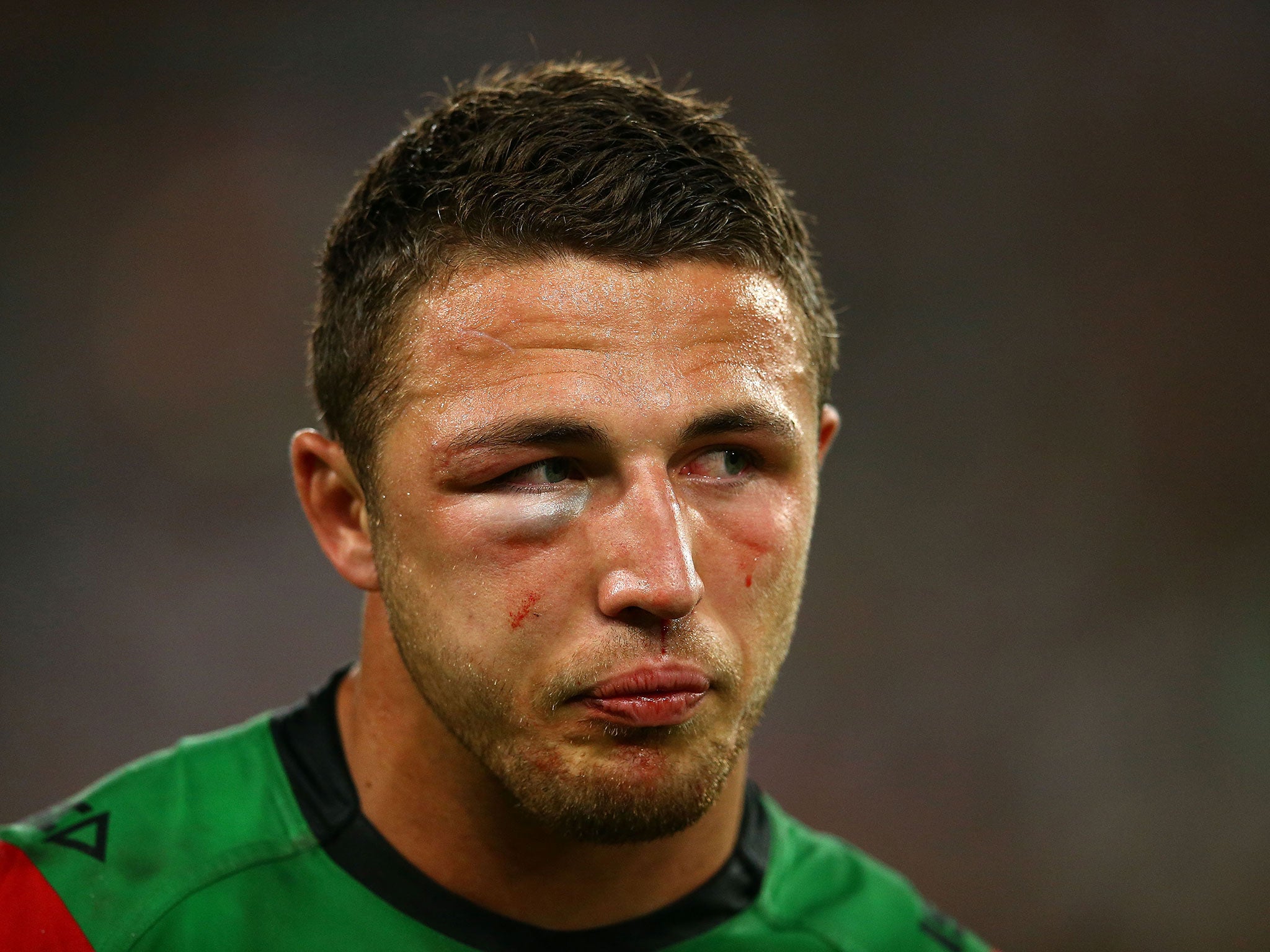 A bloodied and bruised Sam Burgess during the NRL Grand Final