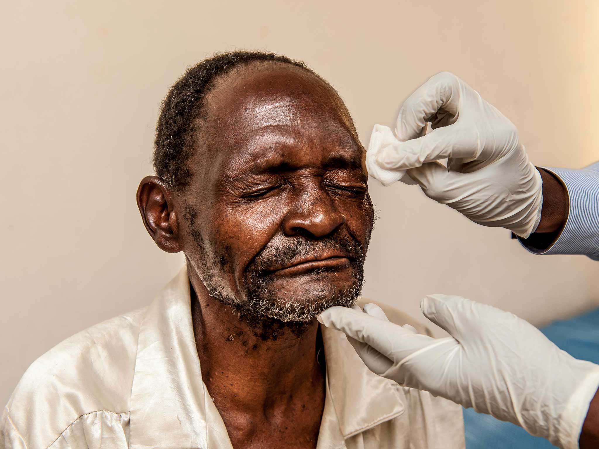 Winesi has his eyes cleaned after the operation (Rachel Palmer/Fieldcraft Studios/Sightsavers)