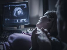 Baby Loss Awareness Week: Too many stillbirths are 'avoidable