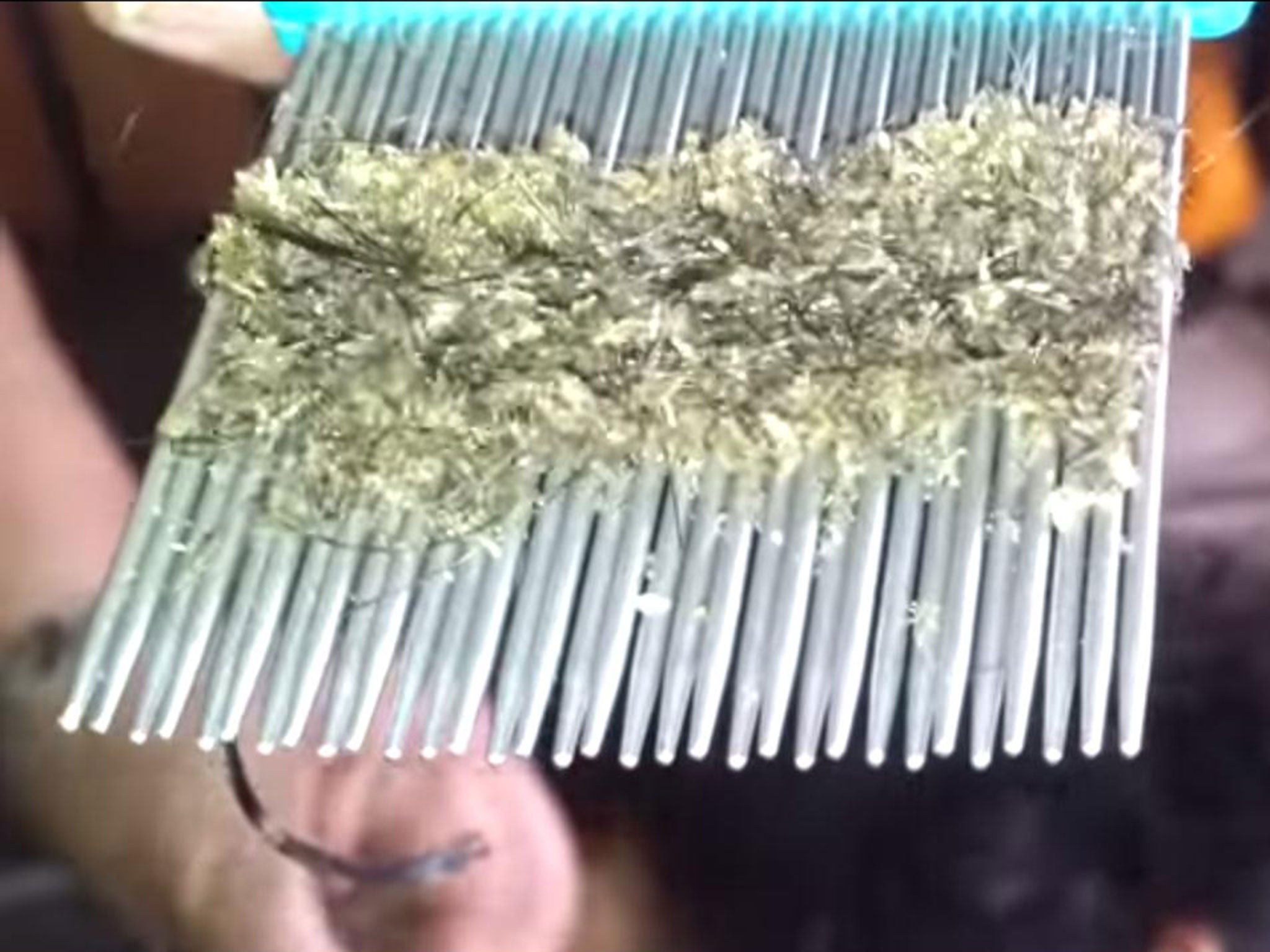 Video of horrifying head lice infestation shows hundreds of nits on a comb  | The Independent | The Independent
