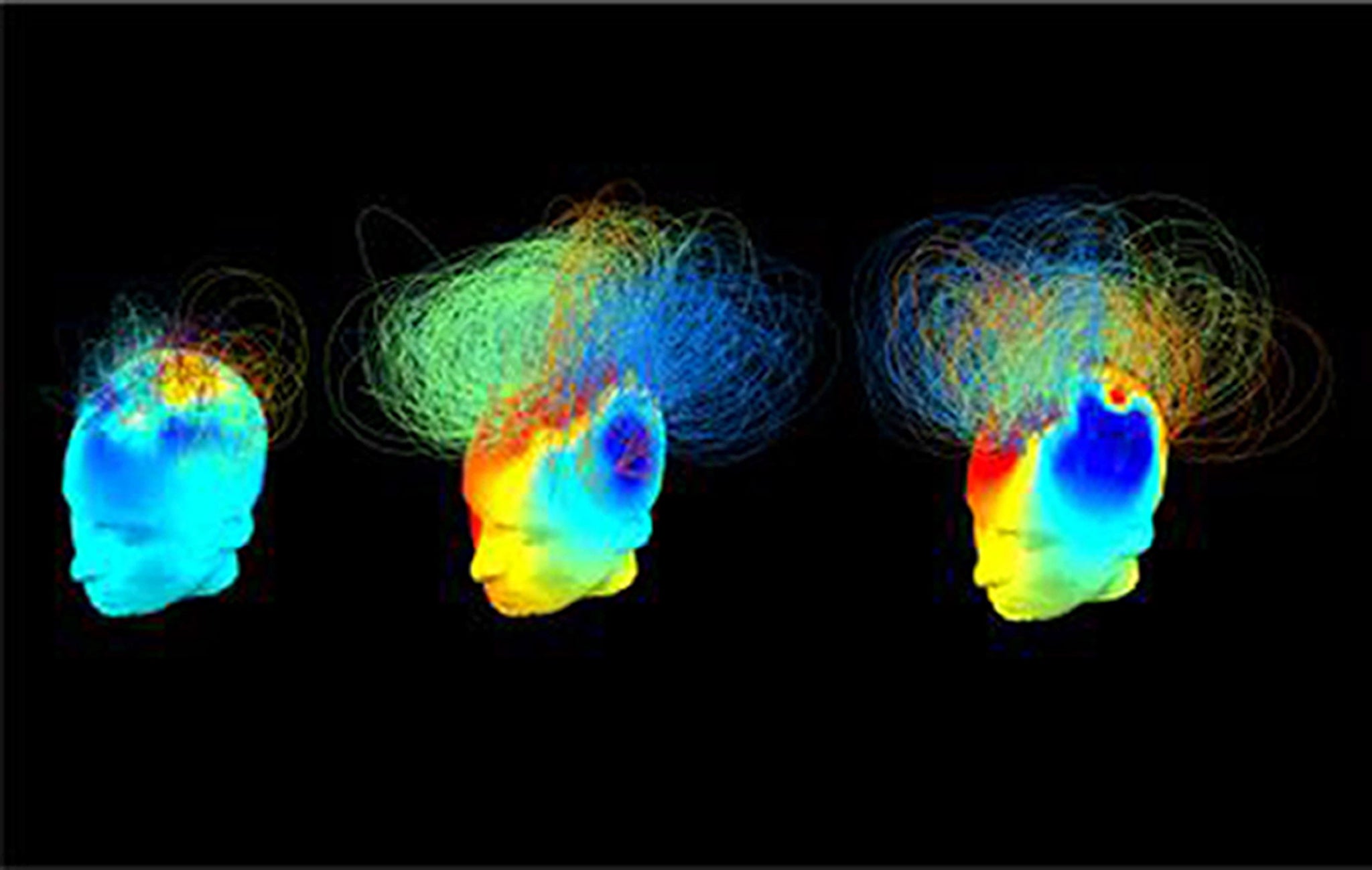 The brain networks in two brain damaged patients (left and middle), one of whom imagined playing tennis (middle), alongside a healthy adult (right)