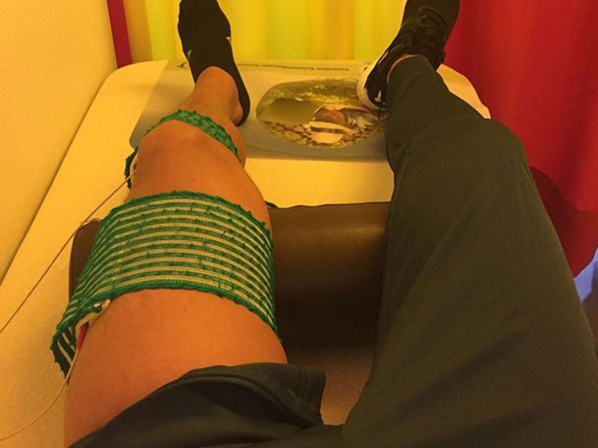 Mesut Ozil posted a picture on Instagram to show his recovery from a knee injury