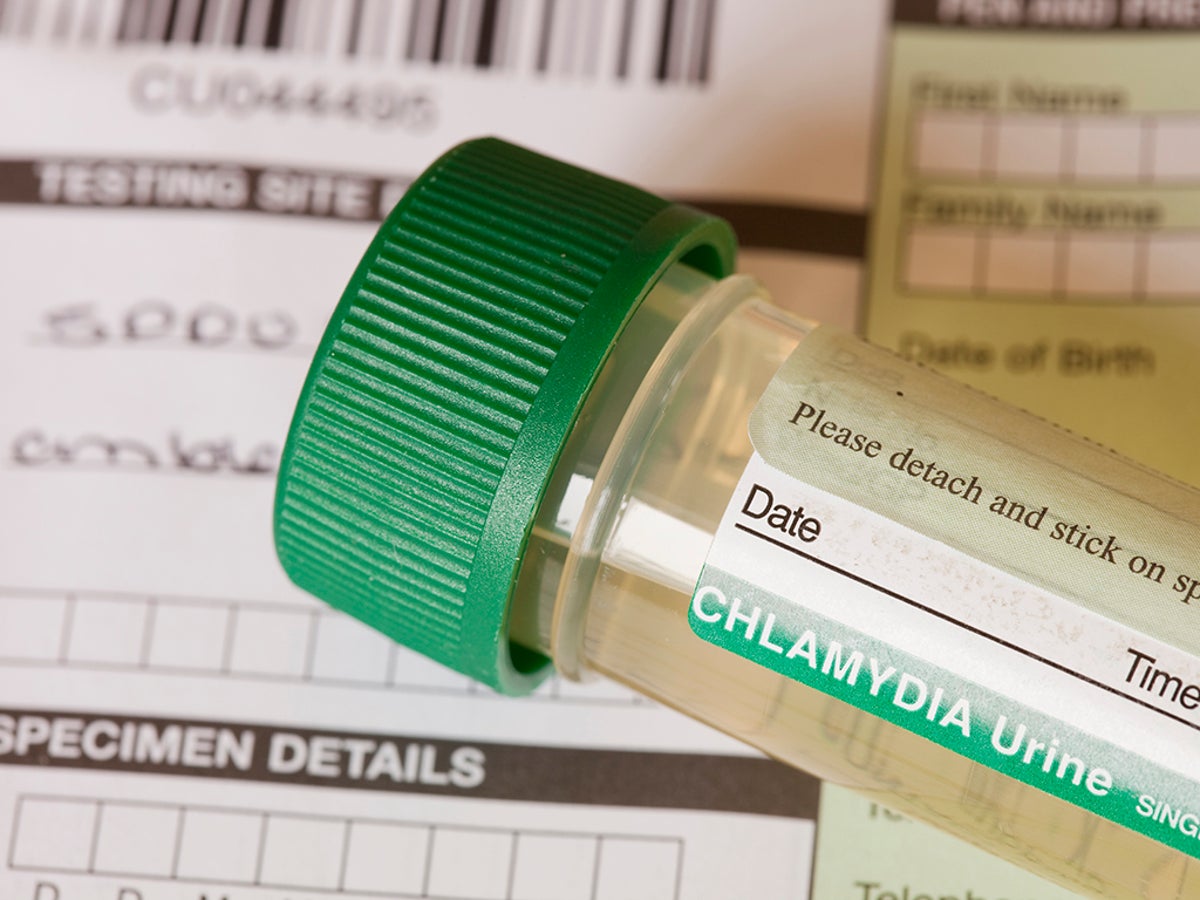 When Should You Tell Someone You Have A Sexually Transmitted Infection The Independent The Independent