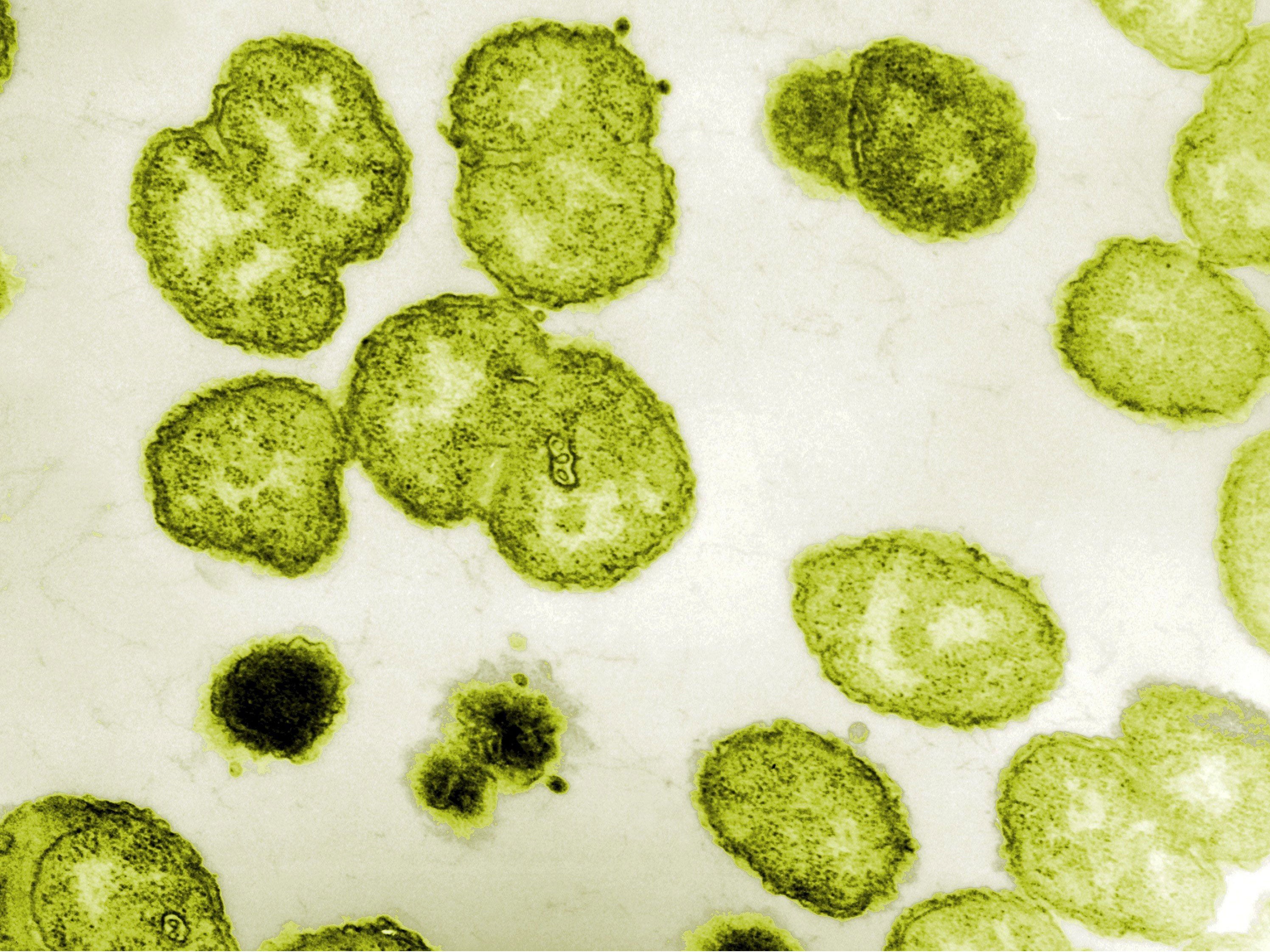 An electron micrograph of Gonorrhea.