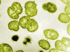 New drug resistant strain of STD gonorrhea found in Australia