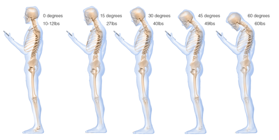 What texting does to your neck. Image credit: Surgical Technology International.