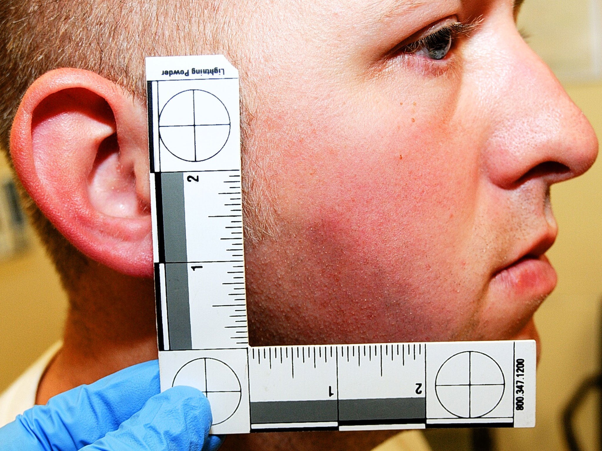 Ferguson police officer Darren Wilson during his medical examination after he fatally shot Michael Brown, in Ferguson