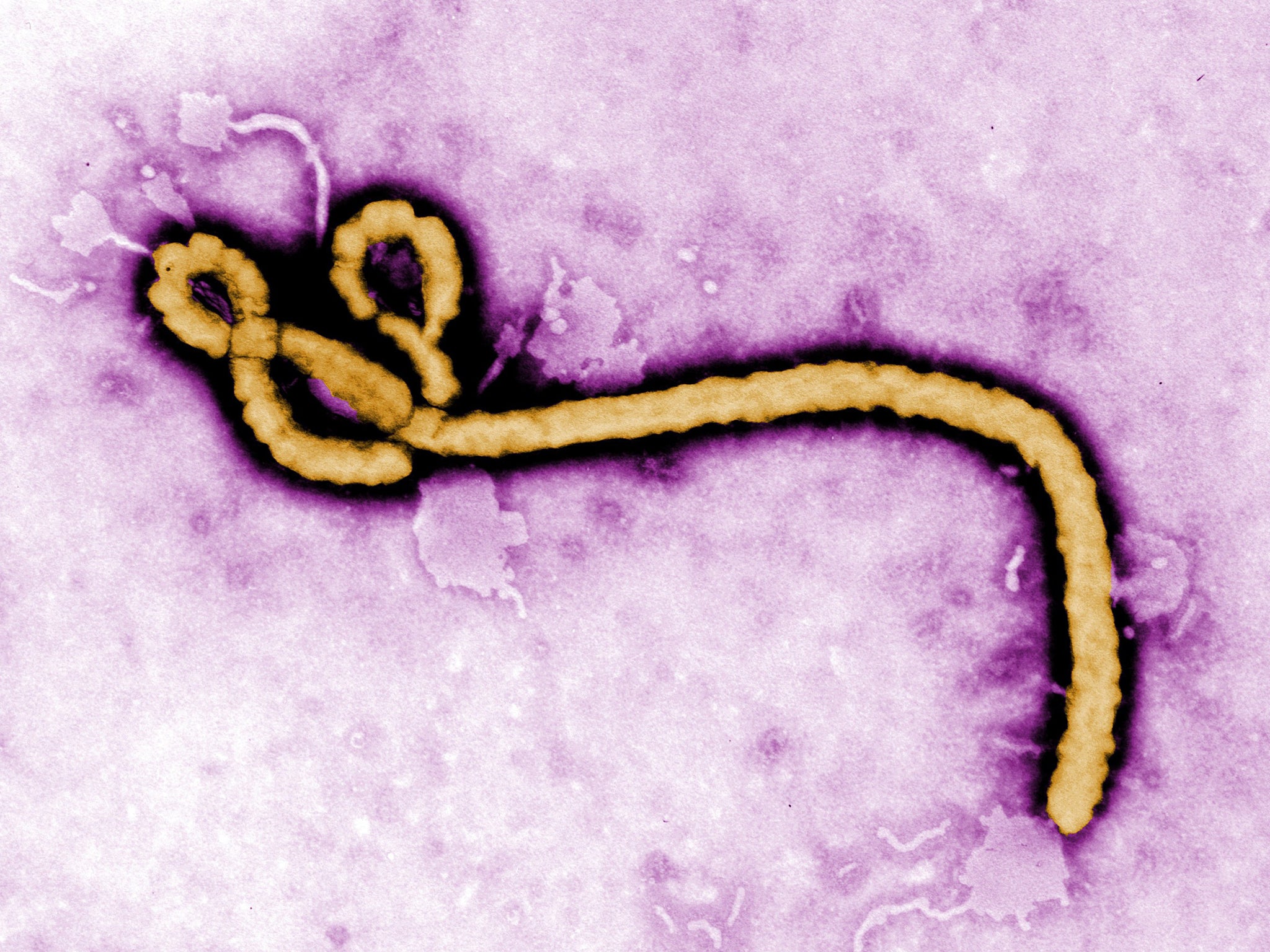 Experts warn people against relaxing their guard over the Ebola virus