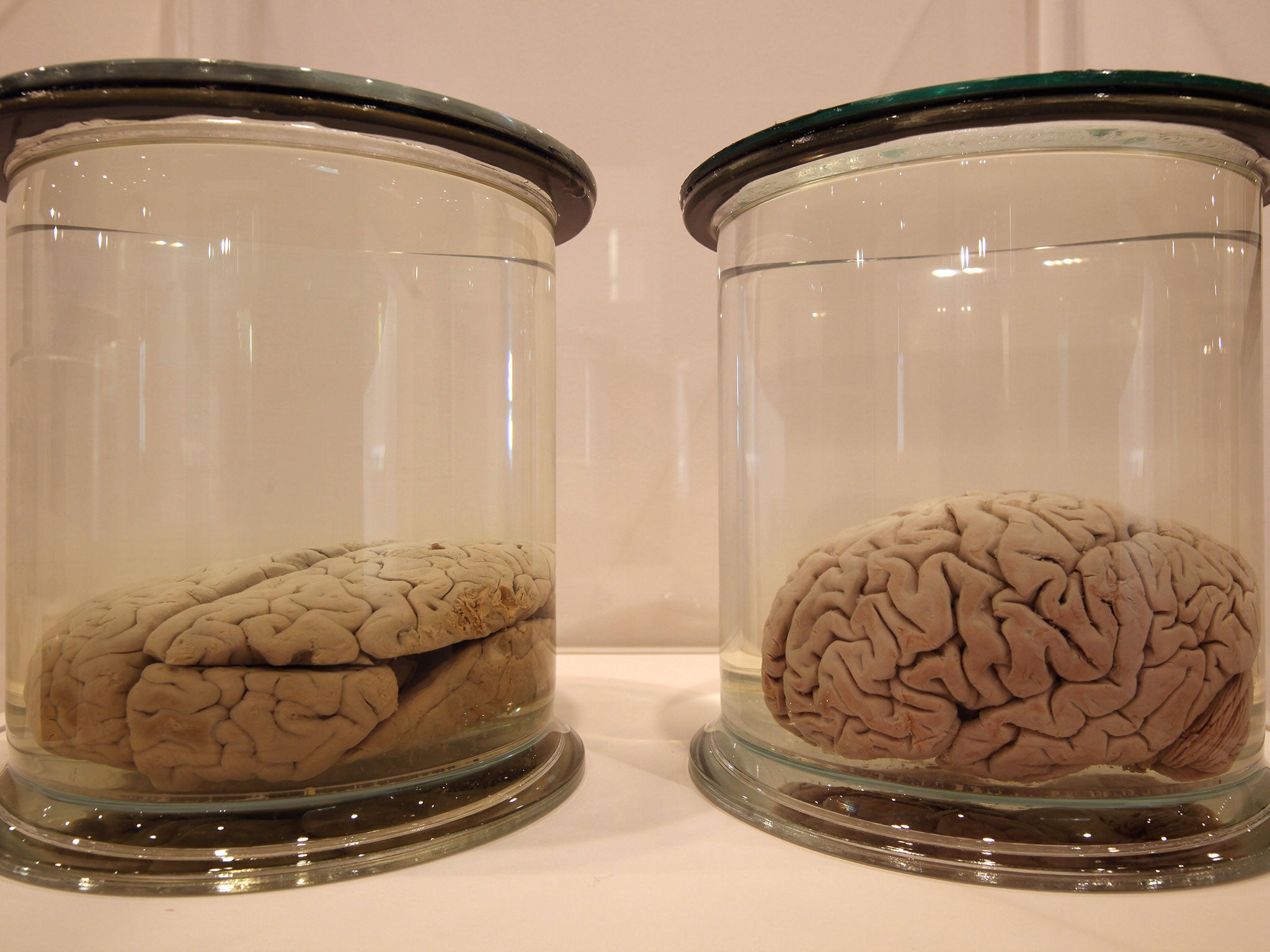 The brains were preserved in jars