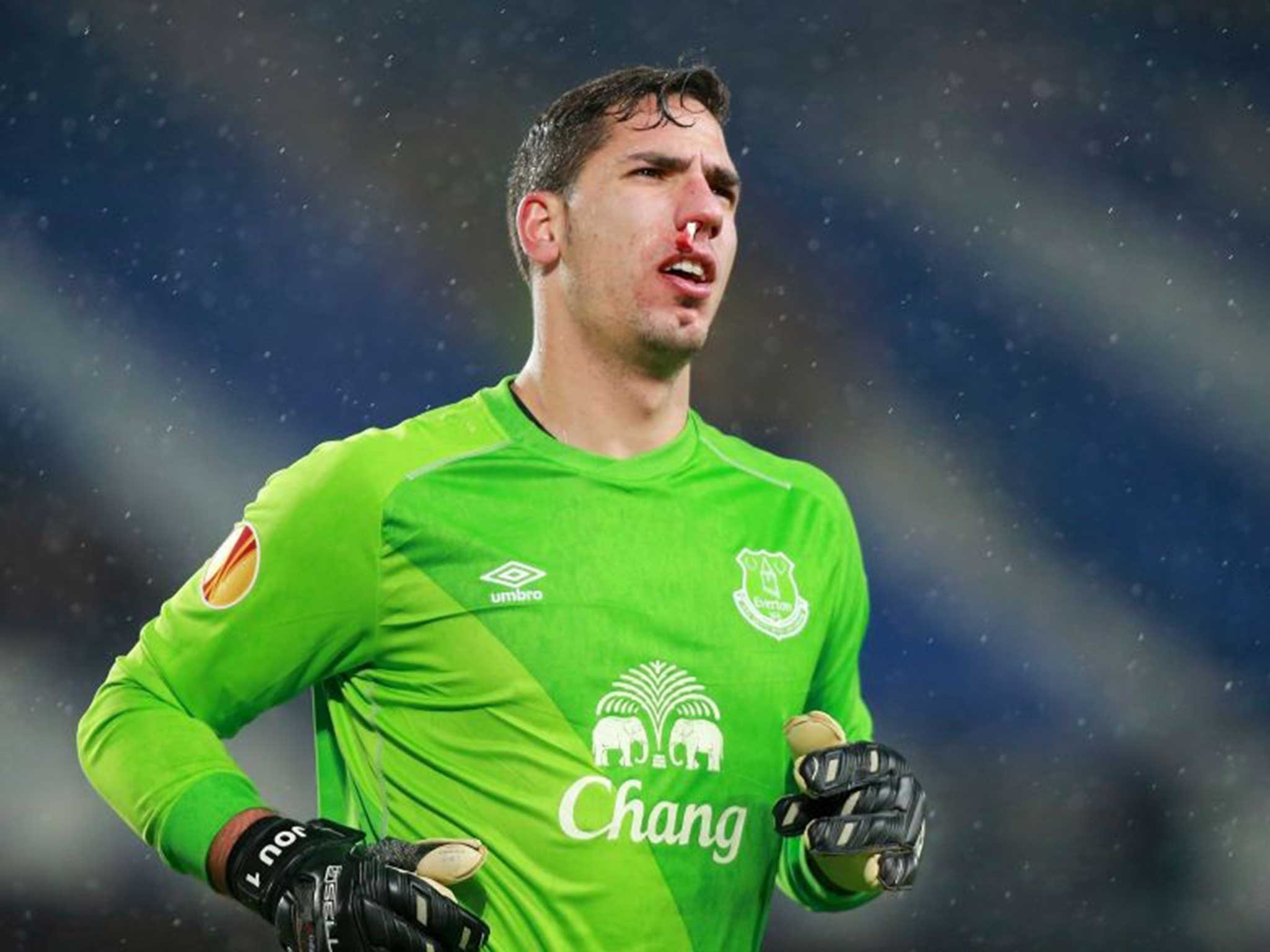 Joel Robles made a rare start for Everton, got a bloodied nose and was at fault for the goal