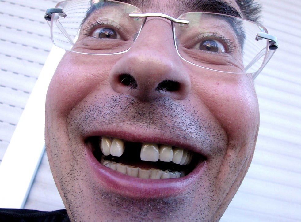 Losing your teeth could be a sign of wider mental and physical decline