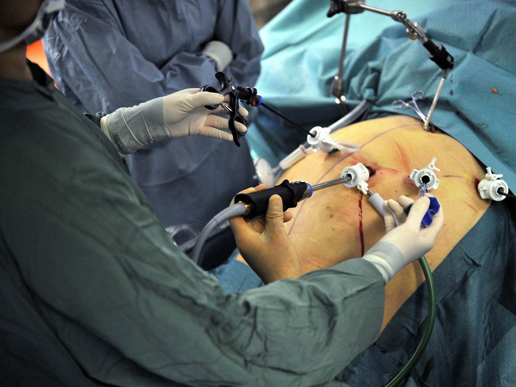 Gastric Surgery Is It Really The Answer To The Uks Obesity - 