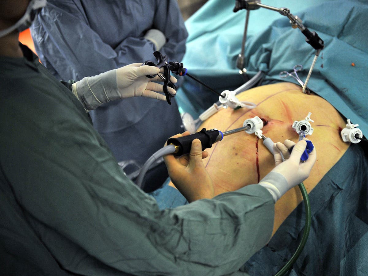 Gastric surgery: Is it really the answer to the UK's obesity epidemic ...